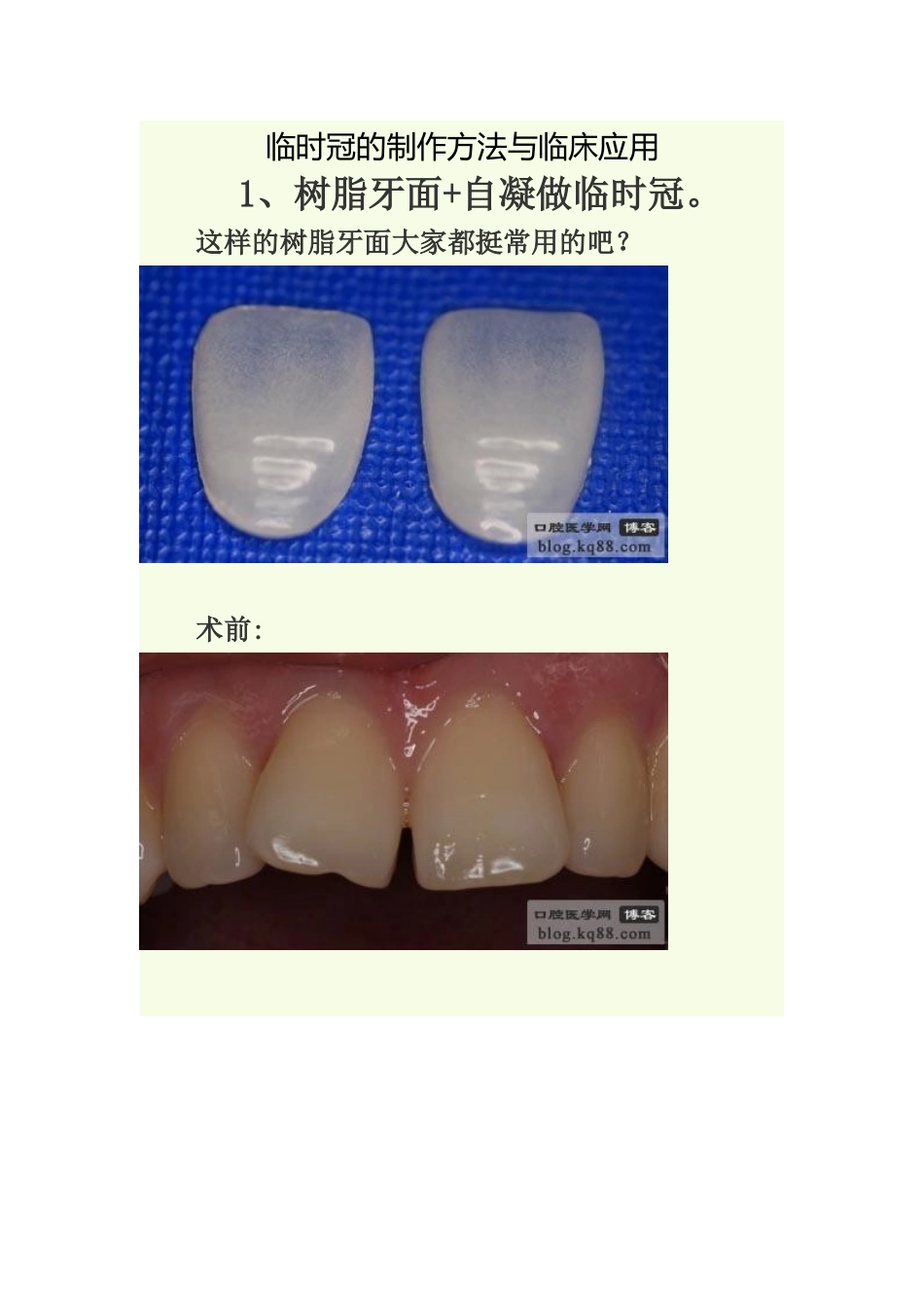 临时冠的制作方法与临床应用_第1页