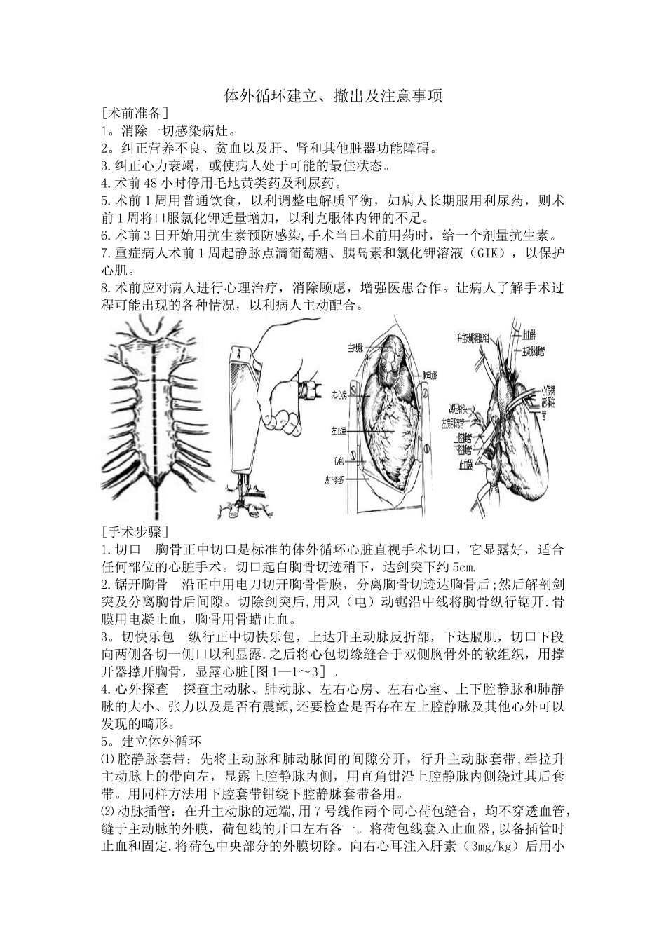 体外循环建立撤除及注意事项_第1页