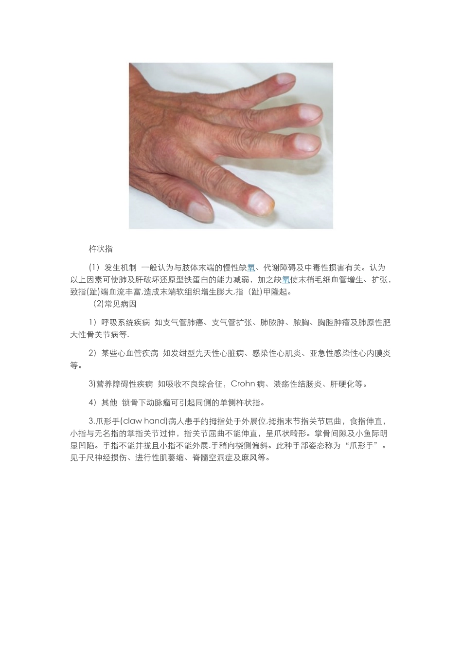 体格检查——四肢与关节检查_第2页