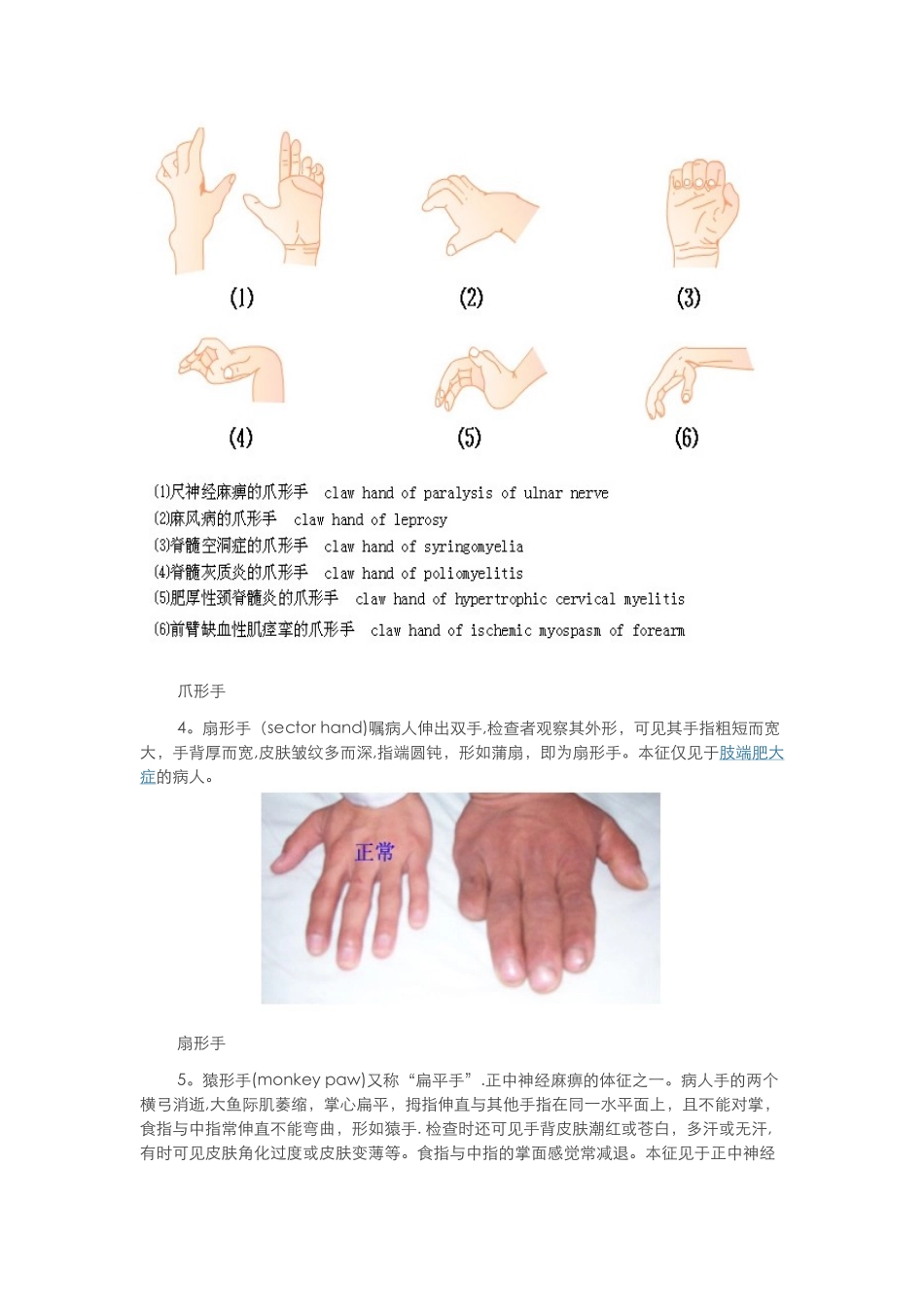 体格检查——四肢与关节检查_第3页