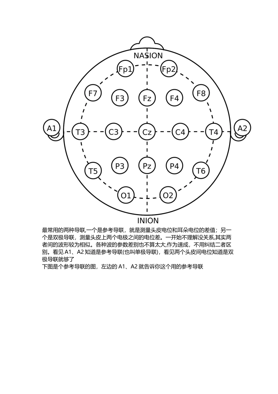 你一定喜欢的脑电图速成_第2页