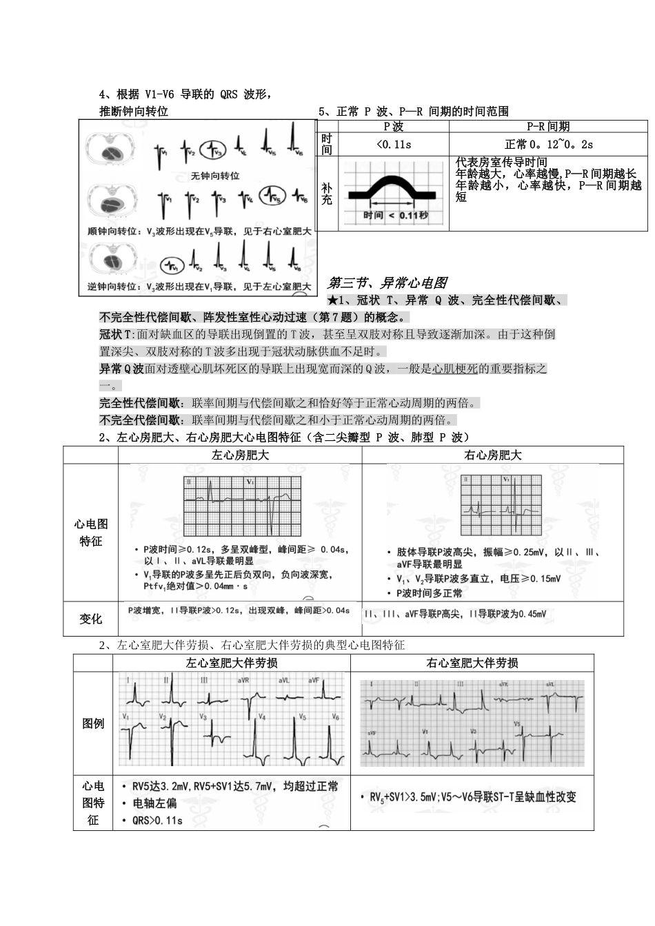 健康评估--心电图重点_第2页