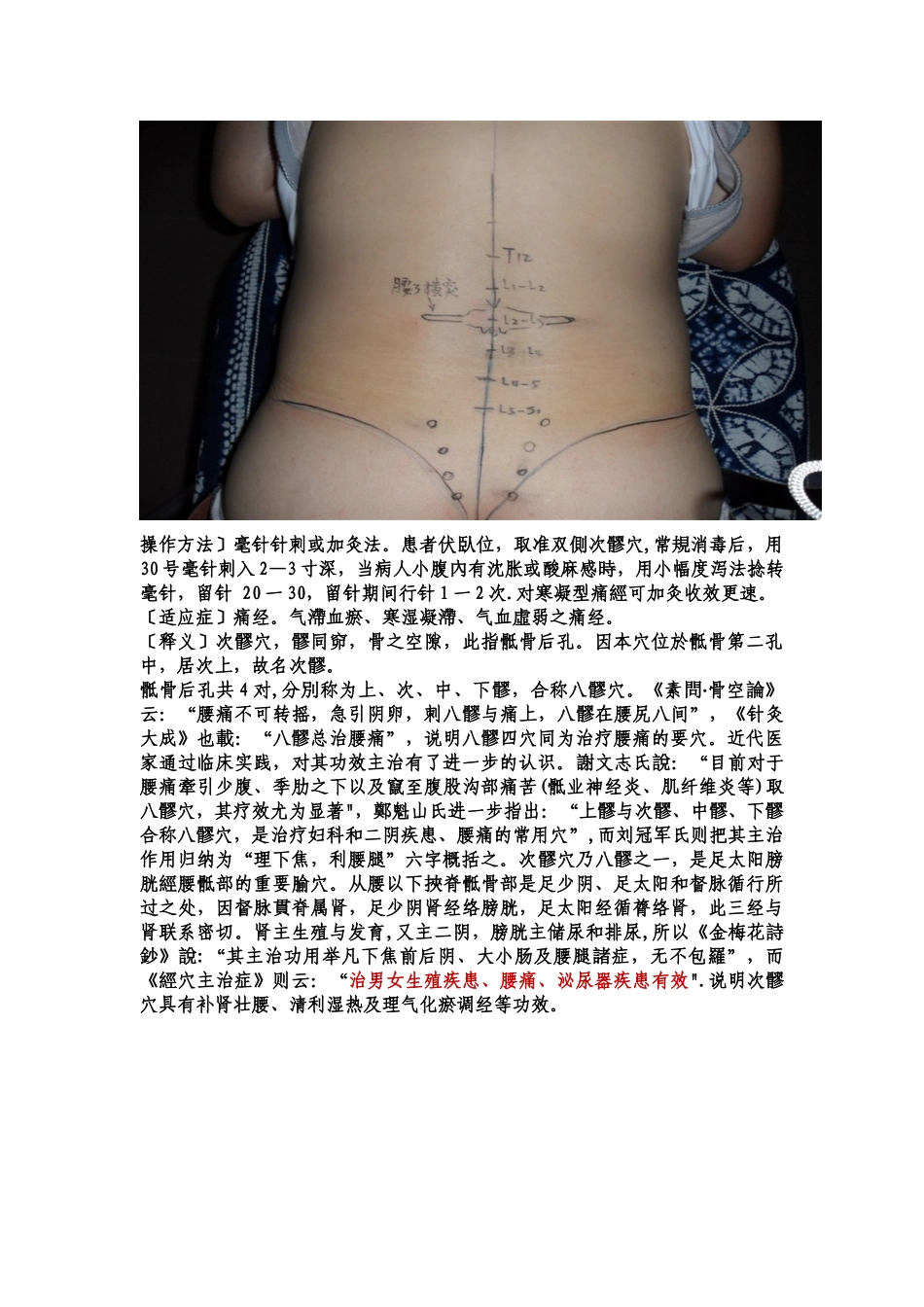 八髎的体表定位_第2页