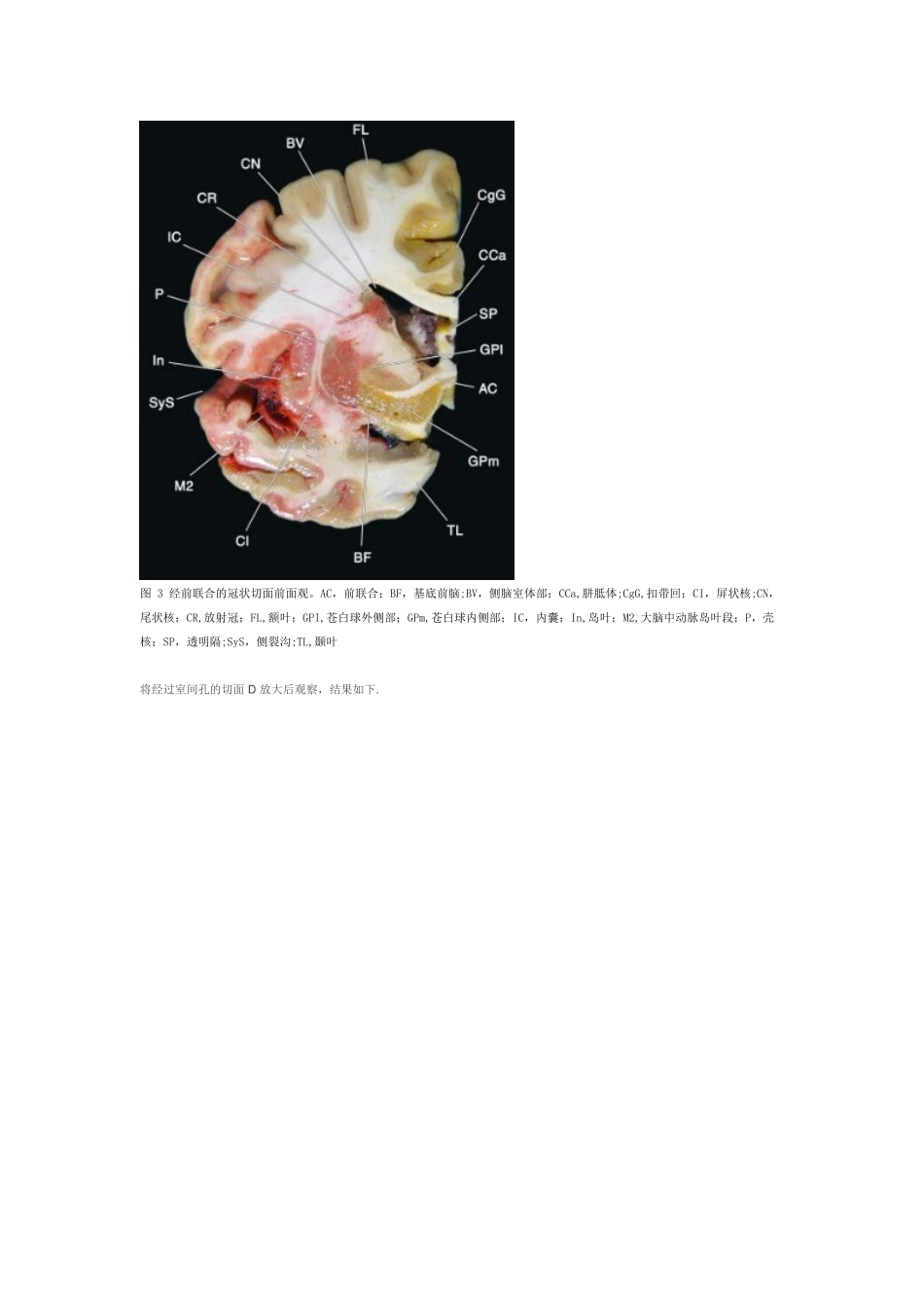 内囊和基底节的血供_第3页