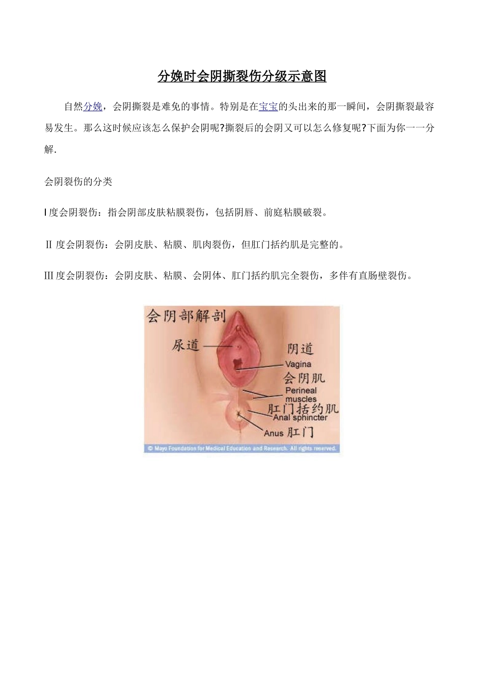 分娩时-会阴撕裂伤分级示意图_第1页