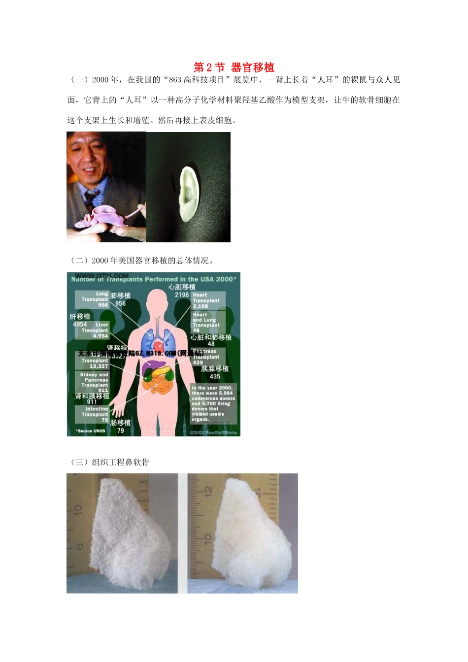 高中生物 第三单元 生物科学与人类健康 第一章 疾病的现代诊断与治疗技术 3.1.2 器官移植（1）素材 中图版选修2-中图版高二选修2生物素材_第1页