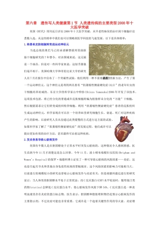 高中生物 第六章 遗传与人类健康 第一节 人类遗传病的主要类型同步素材 浙科版必修2