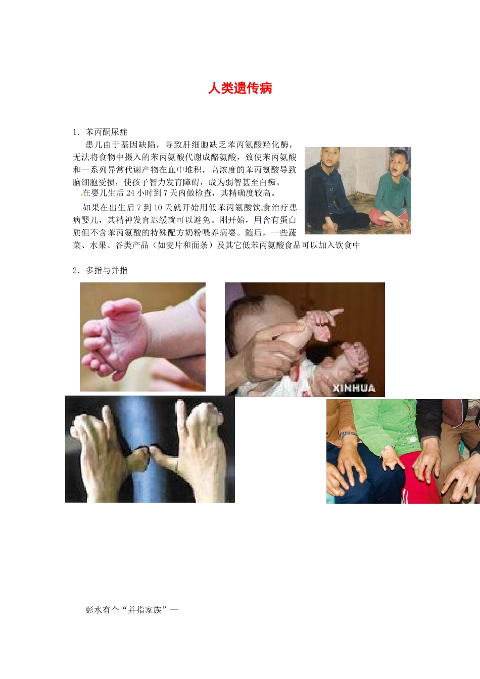 高中生物： 45 关注人类遗传病（素材）苏教版必修2_第1页