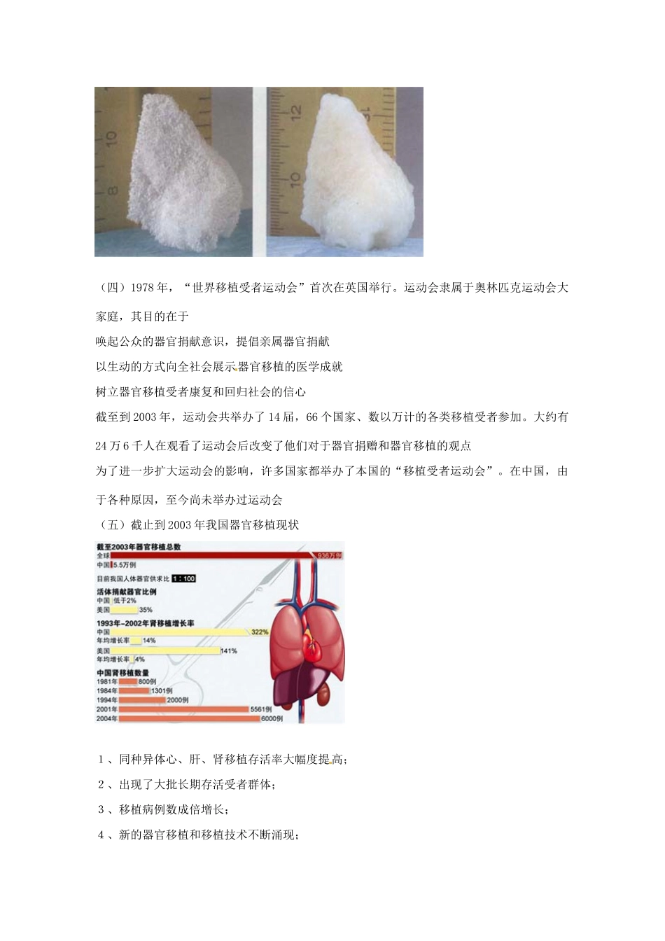 高中生物： 312 器官移植（素材）中图版选修2_第2页