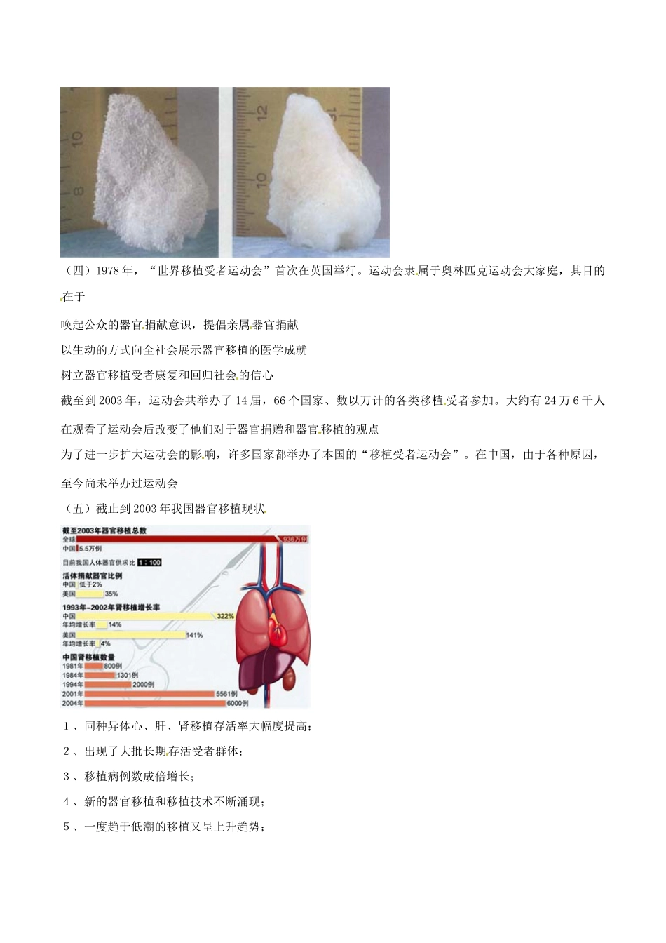 高中生物：1.3《人体的器官移植》素材新人教版选修2_第2页