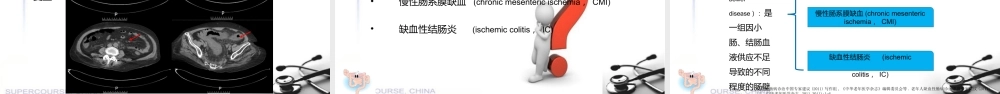 缺血性肠病—病例分享参考课件