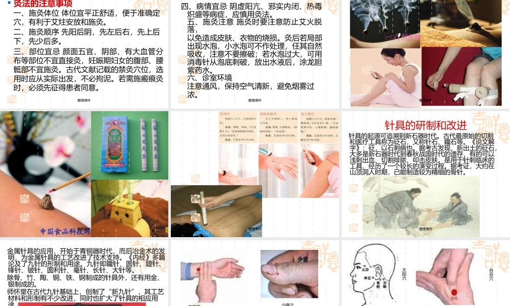 中医护理-中医适宜技术培训