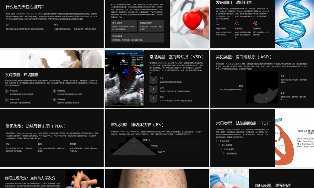 儿童先天性心脏病教学课件