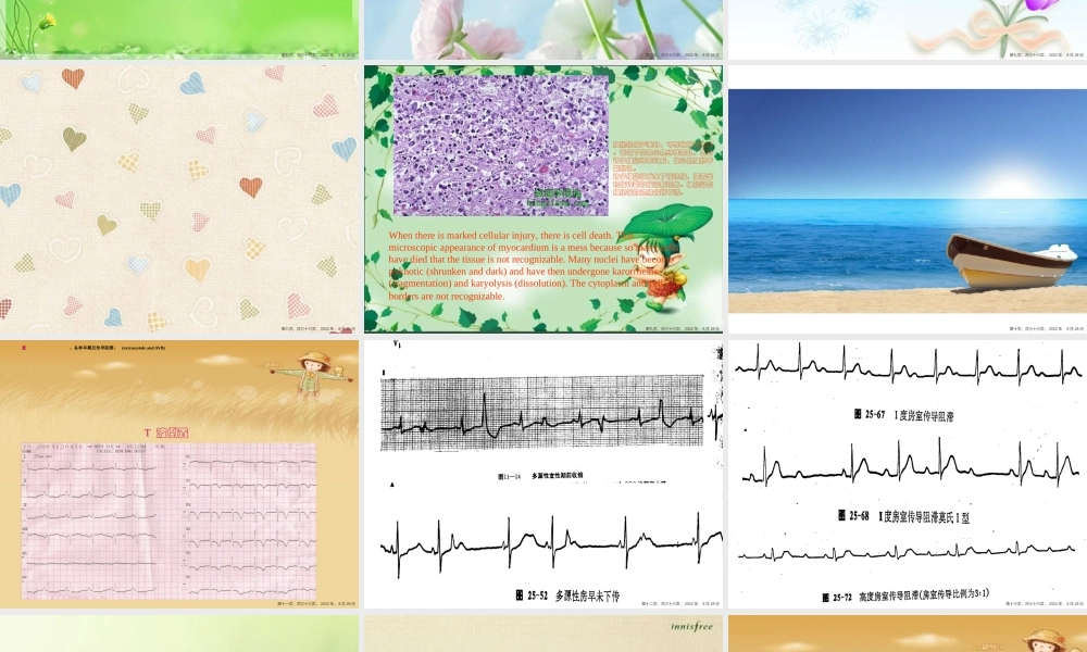 中西医结合儿病毒性心肌炎