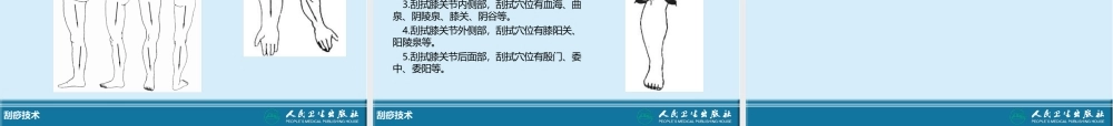 传统康复治疗技术刮痧技术