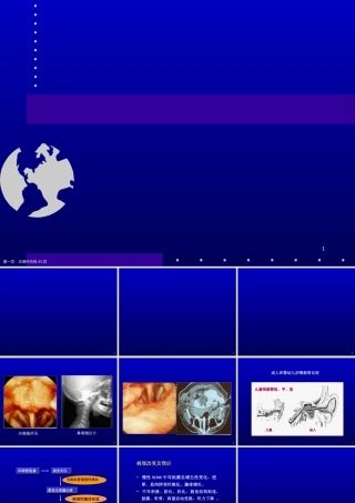 分泌性中耳炎PPT课件课件精选课件