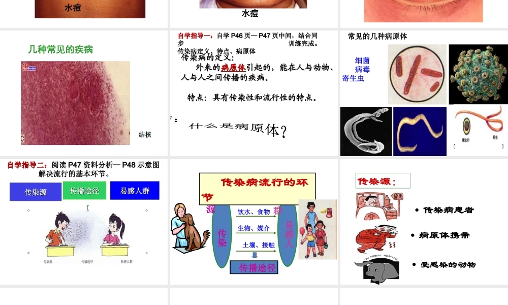 2013届中考生物 查漏补缺复习 专题四 传染病及其预防课件