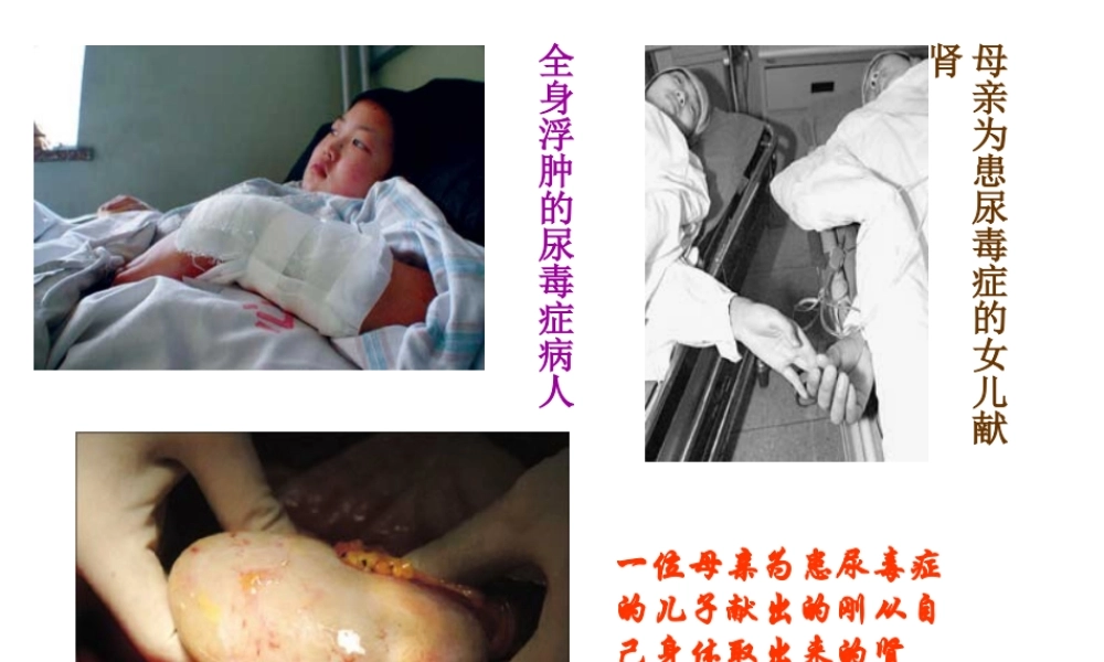 2014七年级生物下册 4.11.1 人体泌尿系统的组成课件二 （新版）苏教版