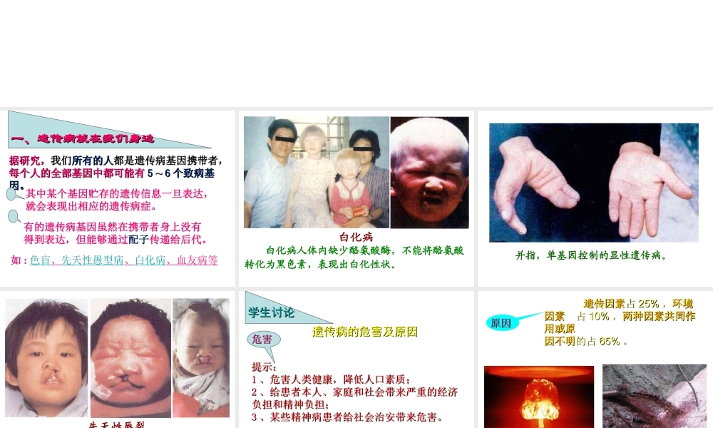 八年级生物上册 20.6《遗传病和人类健康》课件1 （新版）北师大版-（新版）北师大版初中八年级上册生物课件