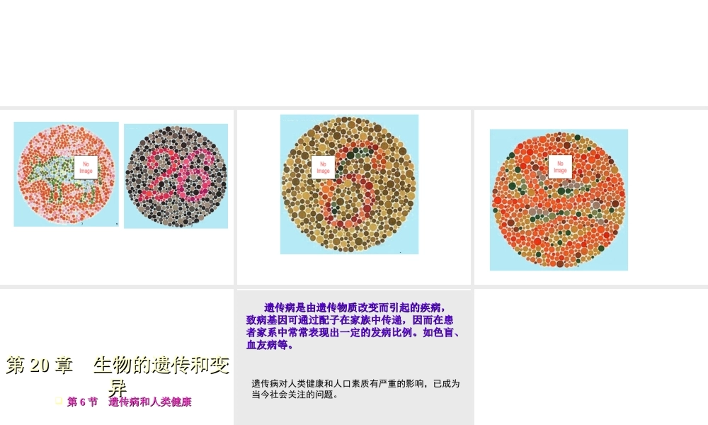 八年级生物上册 20.6《遗传病和人类健康》课件4 （新版）北师大版-（新版）北师大版初中八年级上册生物课件