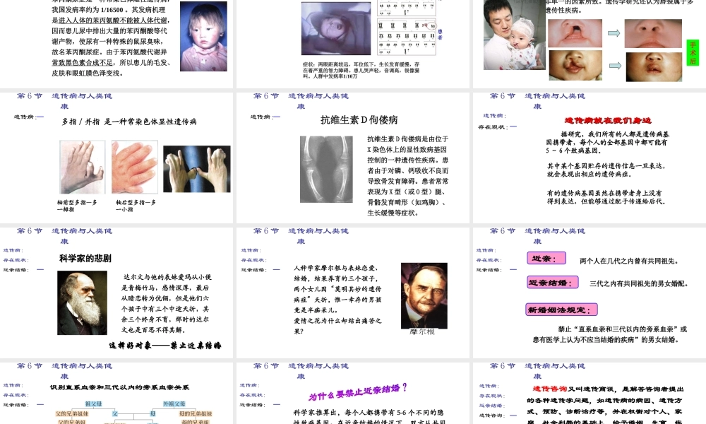 八年级生物上册 《遗传病和人类健康》课件2 （新版）北师大版-（新版）北师大级上册生物课件