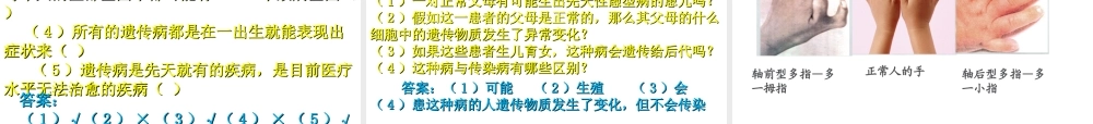 八年级生物上册 《遗传病和人类健康》课件3 （新版）北师大版-（新版）北师大级上册生物课件