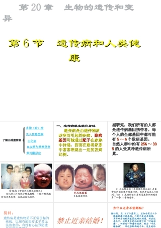 八年级生物上册 《遗传病和人类健康》课件3 （新版）北师大版-（新版）北师大级上册生物课件