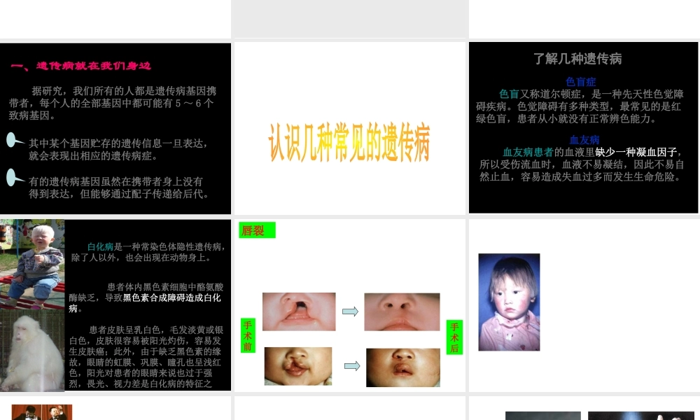 八年级生物上册 《遗传病和人类健康》课件4 （新版）北师大版-（新版）北师大级上册生物课件
