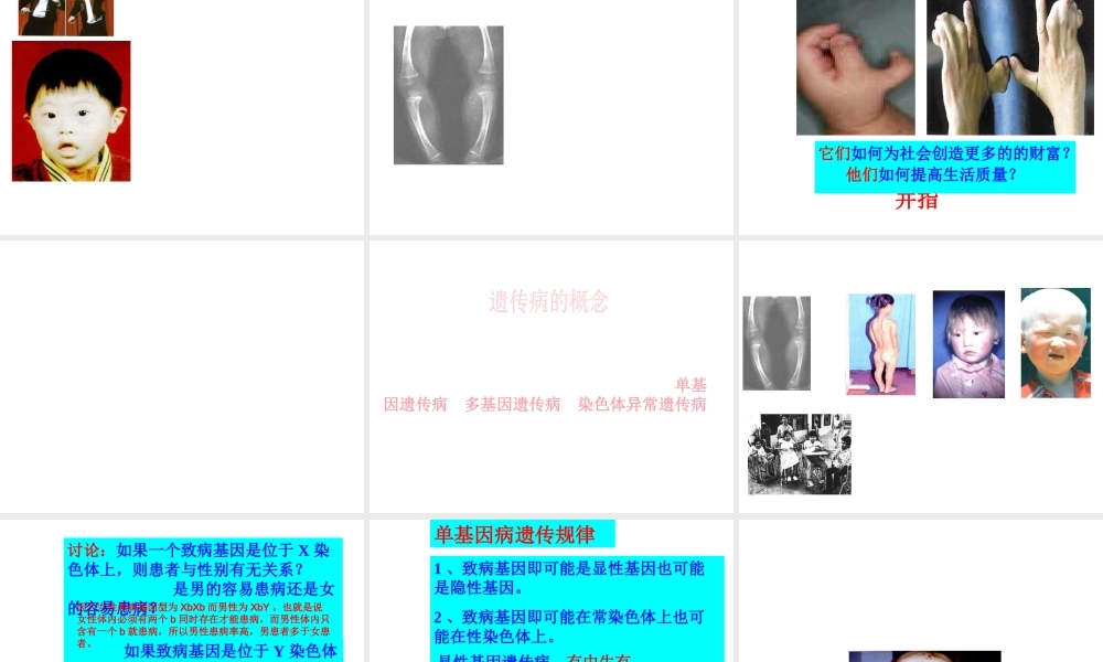 八年级生物上册 《遗传病和人类健康》课件4 （新版）北师大版-（新版）北师大级上册生物课件
