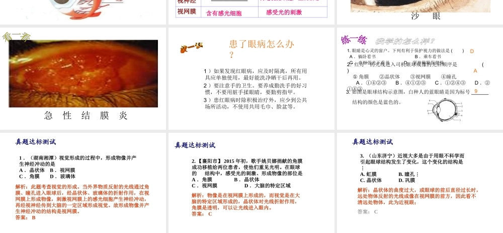 八年级生物上册 6.16.2人体对信息的感知（眼与视觉）课件1 （新版）苏科版-（新版）苏科版初中八年级上册生物课件