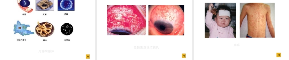 八年级生物上册 传染病课件 苏教版