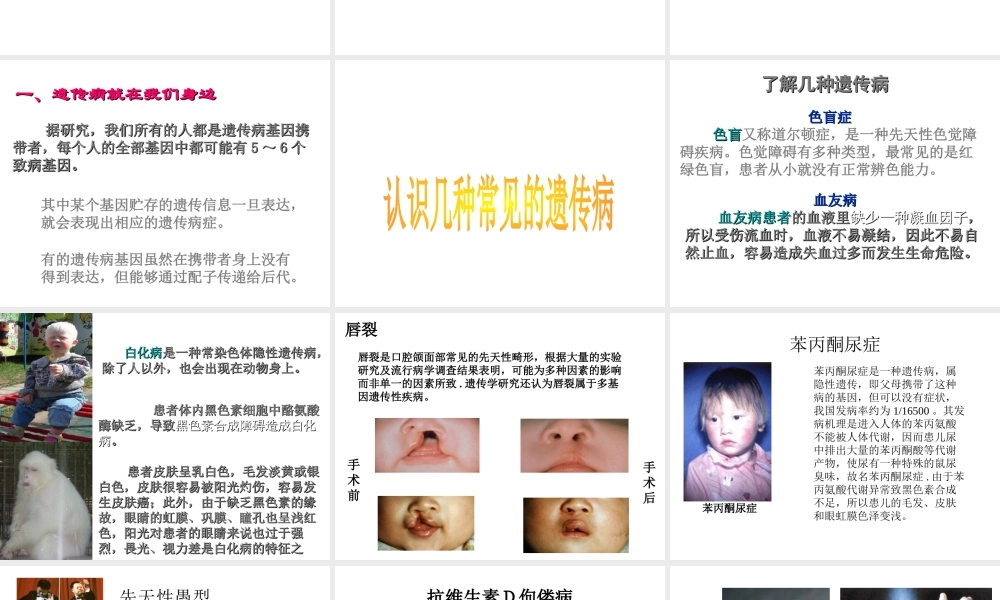 八年级生物上册 第六单元 第六节 遗传病和人类健康课件 北师大版