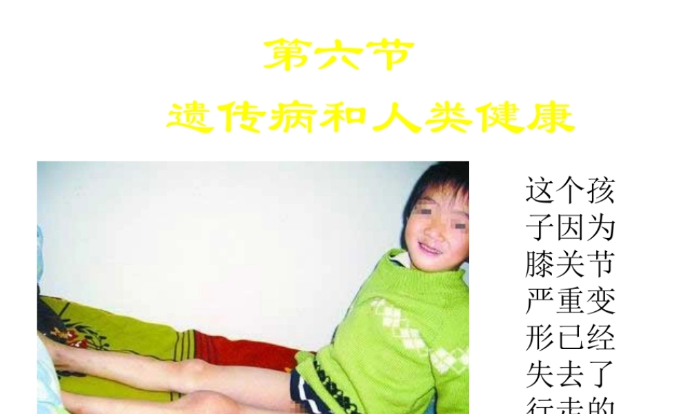 八年级生物上册 第第6节 遗传病和人类健康课件1 北师大版-北师大级上册生物课件