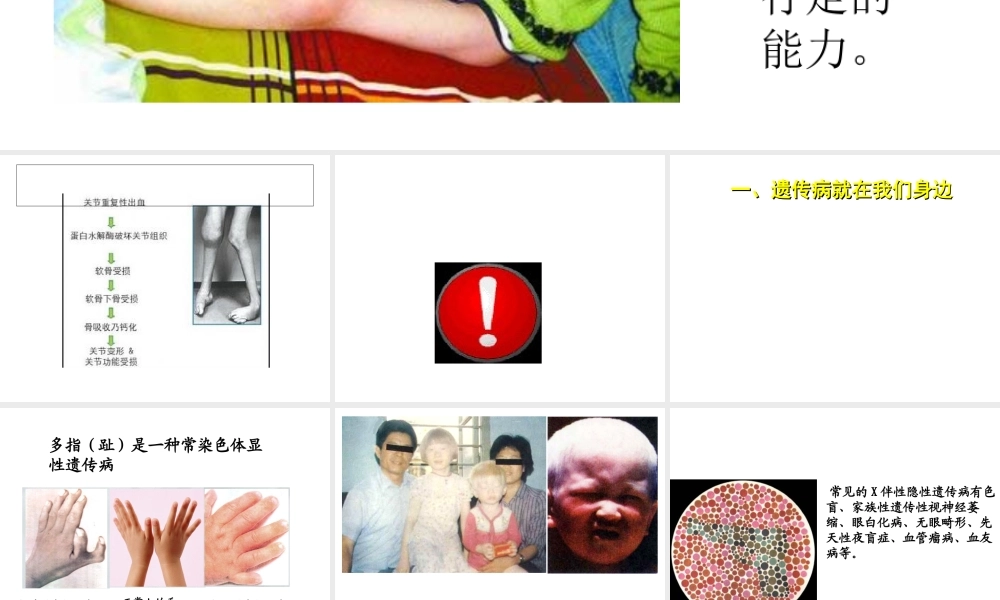 八年级生物上册 第第6节 遗传病和人类健康课件1 北师大版-北师大级上册生物课件