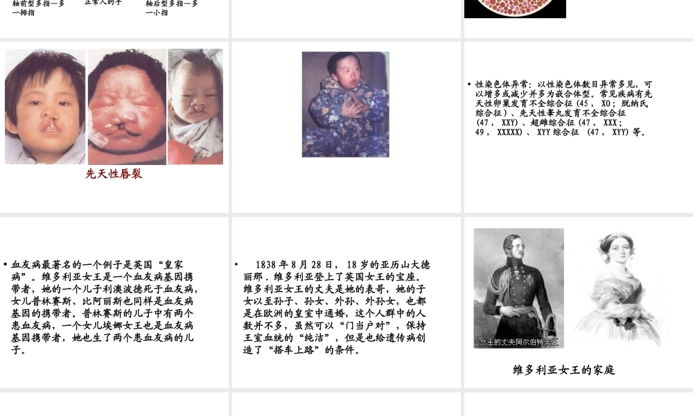 八年级生物上册 第第6节 遗传病和人类健康课件1 北师大版-北师大级上册生物课件
