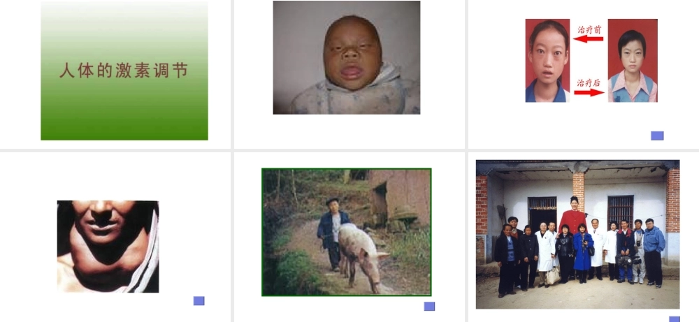 八年级生物上册《人体的激素调节》课件1 教科版