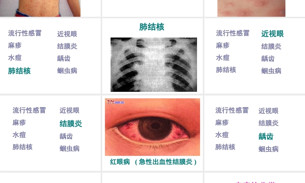 八年级生物下册 8.1.1传染病及其预防课件3 （新版）新人教版-（新版）新人教版初中八年级下册生物课件