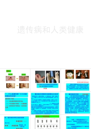 八年级生物上册《遗传病和人类健康》课件2 北师大版