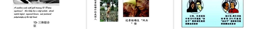 八年级生物上册《遗传和优生优育》》课件 苏教版