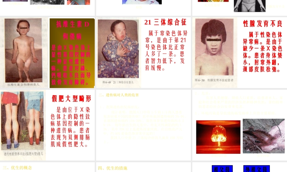 八年级生物下册 6.2.3 遗传病与优生课件 冀教版-冀教版初中八年级下册生物课件