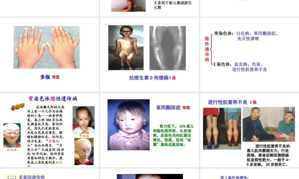 八年级生物下册 第15章 第4节 遗传病和优生优育课件 苏教版