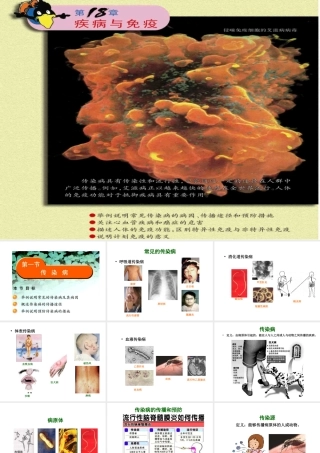 八年级生物下册 25.1 传染病课件 （新版）苏教版-（新版）苏教级下册生物课件