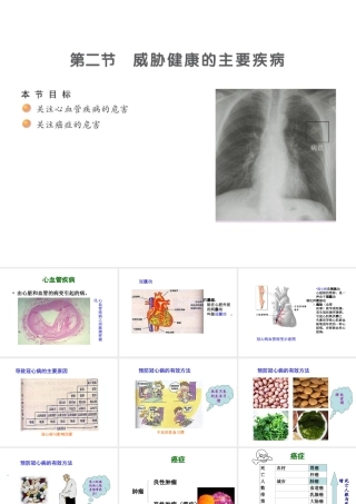 八年级生物下册 25.2 威胁健康的主要疾病课件 （新版）苏教版-（新版）苏教版初中八年级下册生物课件