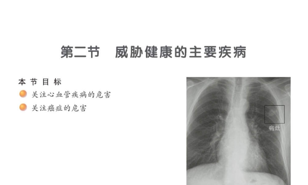 八年级生物下册 25.2 威胁健康的主要疾病课件 （新版）苏教版-（新版）苏教级下册生物课件