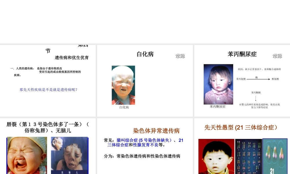 八年级生物下册 22.4 遗传病和优生优育课件 （新版）苏教版-（新版）苏教级下册生物课件