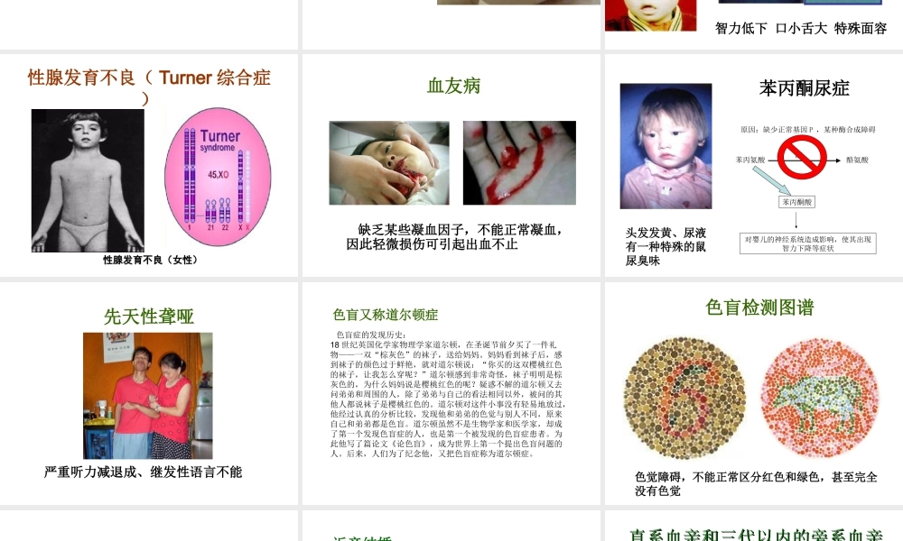 八年级生物下册 22.4 遗传病和优生优育课件 苏教版-苏教版初中八年级下册生物课件