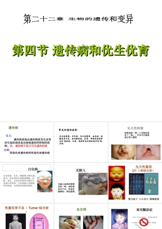 八年级生物下册 22.4 遗传病和优生优育课件 苏教版-苏教级下册生物课件