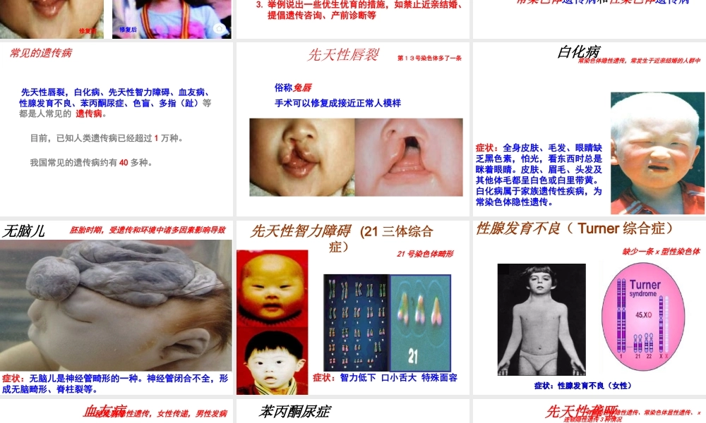 八年级生物下册 第八单元 生物的生殖、发育与遗传 第二十二章 生物的遗传和变异 第四节 遗传病和优生优育课件3（新版）苏教版-（新版）苏教版初中八年级下册生物课件