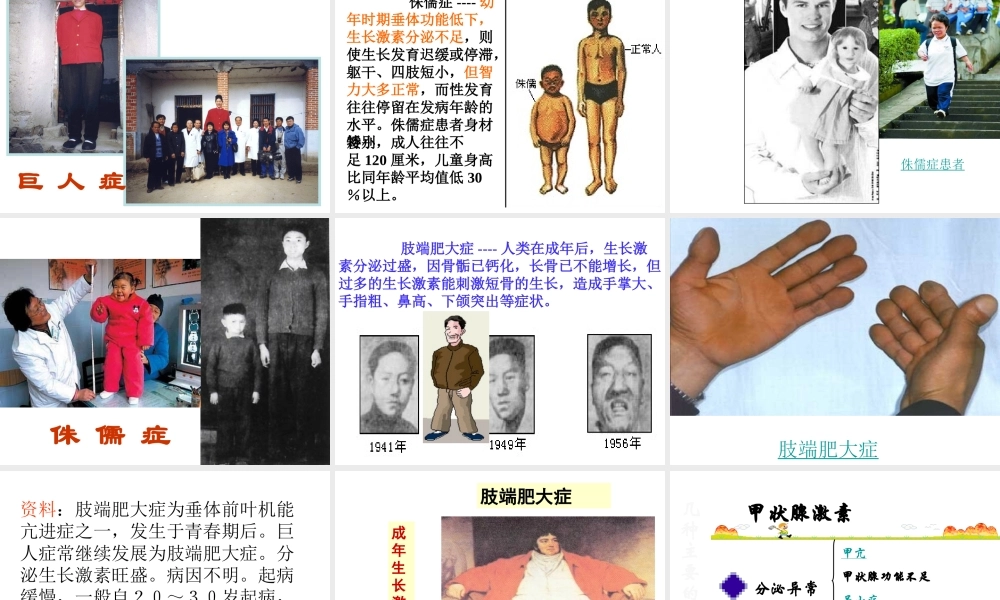 八年级科学上册 3.2 人体的激素调节课件2 浙教版-浙教版初中八年级上册自然科学课件