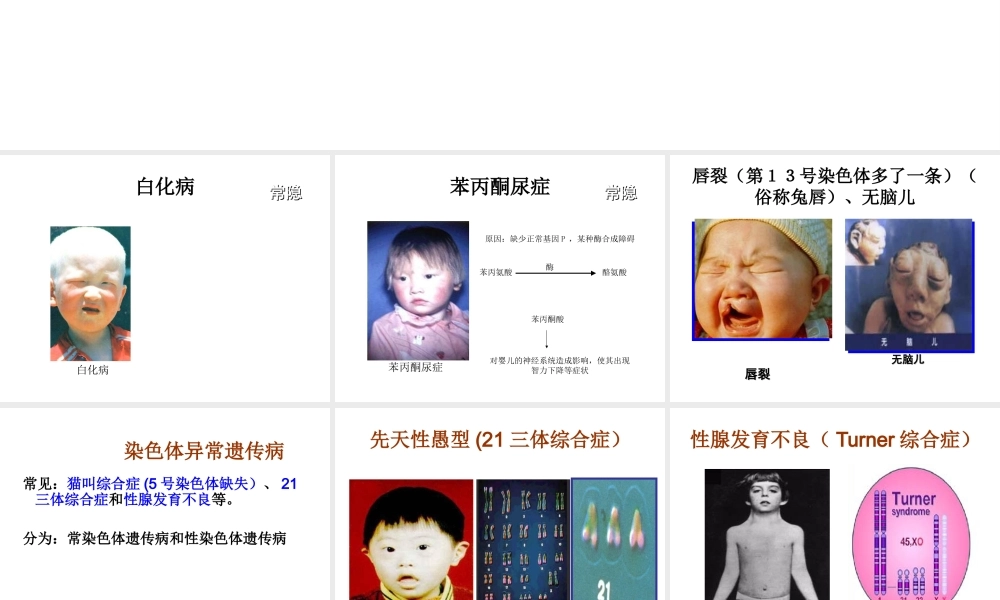 八年级生物下册 第二十二章 第四节 遗传病和优生优育课件2 （新版）苏教版